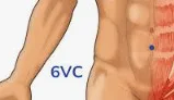 Vc 6